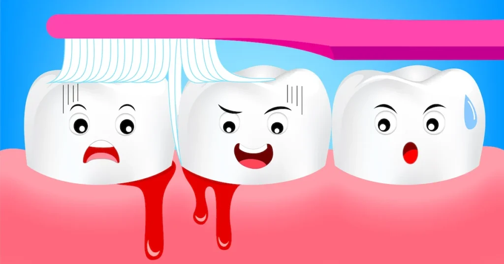 Is Bleeding Gums an Early Sign of Gum Disease Leighton Buzzard?